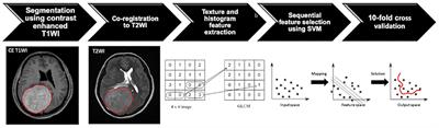 Pre-operative MRI Radiomics for the Prediction of Progression and Recurrence in Meningiomas